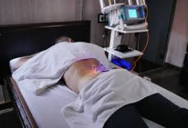 Degenerative Disc Treatments - StemCells 21