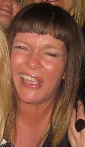 Recovery from bell's palsy depends on the extent and severity of damage to the seventh cranial nerve. Jacquie S Story Facial Palsy Uk
