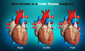Pin On Plastic Surgery Tips