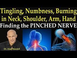 Tingling Numbness Burning In Neck Shoulder Arm And Hand Finding The Pinched Nerve Youtube Pinched Nerve Nerve Relief Pinched Nerve In Neck