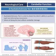 Image result for Cerebellar Function Test