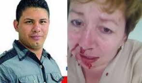 Edil del Partido de La U golpeó a líder defensora de las mujeres