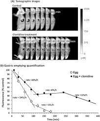 The gastric emptying study will show if you have slow or rapid emptying of your stomach. Stomach Emptying An Overview Sciencedirect Topics