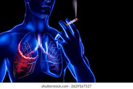 Cigarette-related Lung Damage ...