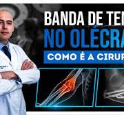 SAIBA COMO É FEITA A CIRURGIA DA BANDA DE TENSÃO NO OLECRANO | FRATURA DO  OLECRANO