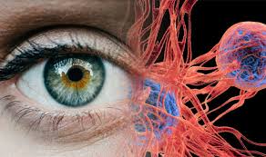 Blockage and discharge from the nose and throat, and occasionally an eye may. Eye Cancer Signs Watch Out For A Dark Spot On The Coloured Part Of The Eye Express Co Uk