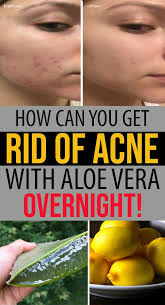 Pin On Skin Care