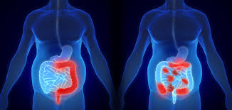 About 1 in 21 people will get this. 5 Facts We Now Know About Colorectal Cancer Johnson Johnson