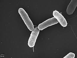 It's caused by salmonella bacteria. Salmonellosis Pathology Britannica