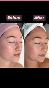 Just look at that transformation 😍, My gorgeous client has been