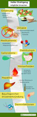 Er kann jedoch auch ein symptom ernster erkrankungen des darms oder der leber sein. Heller Stuhlgang Ursachen Und Gegenmittel