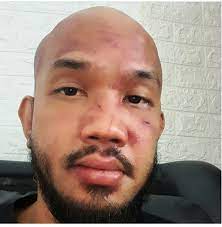 Pada saat theo jatuh pun tangan kanan saya tidak bisa memukul dengan maksimal. Kalah Di One Pride Mma Theodorus Ginting Memuji Kerendahan Hati Windri Patilima Perasaan Saya Hancur Portal Sulut Halaman 2