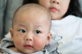 We did not find results for: Pityriasis Alba Rentan Menyerang Anak Anak Ini Alasannya