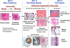 Here, how to help your pet heal. Tuberculosis As A Three Act Play A New Paradigm For The Pathogenesis Of Pulmonary Tuberculosis Sciencedirect