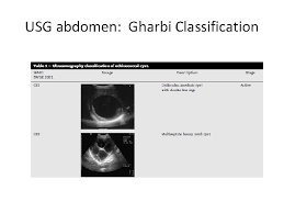 A catheterization technique was performed but hypertonic saline and alcohol were not given into the cavity due to cystobiliary leakage. Hydatid Cyst Dr Dhiresh Kumar Maharjan 12 Th