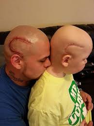 Dad Gets Scar Tattoo to Match His Son's Brain Cancer Surgery Scar