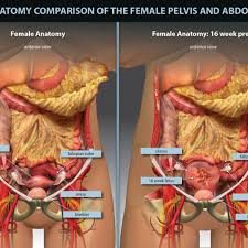 Historical artwork of the internal anatomy of a female abdomen, shown by a vertical slice seen from the side. Female Pelvis And Abdomen Comparison Trialexhibits Inc