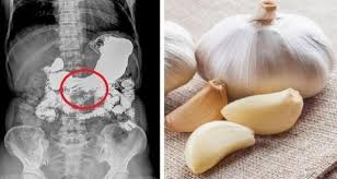 Maybe you would like to learn more about one of these? Cara Makan Bawang Putih Malaysian Today