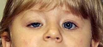 Image result
