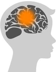 The most common childhood cancer, affecting about 30% of children with cancer; Canadian Researchers Discover Unsuspected Early Origins Of Childhood Brain Cancer Biocrick News Center