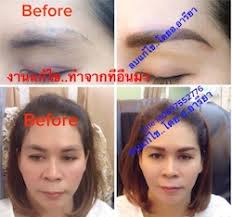 การแก้ไขลบคิ้วเดิมเปลี่ยนเป็นคิ้ว 3,6 มิติ