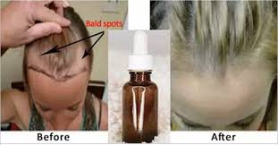 Eta Syvorotka Pohozha Na Volshebnoe Zele Eto Uvelichit Rost Volos Ochen Bystro Bolshe Nikak Hair Growth Serum How To Grow Natural Hair Essential Oils For Hair
