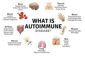 Autoimmune Disease Addressing Four Causes Flourish Compounding Nutrition