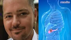 'Le dijeron a mi esposo que su dolor era ciática; murió de cáncer de  páncreas poco después'