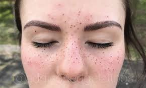 FRECKLES & LASHLINE PORTFOLIO — ADDISON EDGE