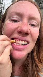 Randy Bourque Tooth After Match