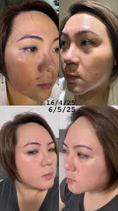 Has anyone had good results with this brand for their skin?