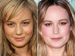 Shannen doherty talks plastic surgery smash this link button! Brie Larson Before And After Nose Job Jennifer Aniston Nose Job Jennifer Aniston Nose