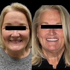 Smile Obsession ™ 🦷（@smile.obsession）• Instagram 相片與影片