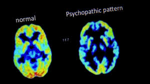 Pin On Serial Killer Psychology