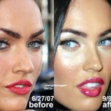 She never did lip fillers, botox infusion, cheek growth or other sort of plasticsurgery. Good Plastic Surgery Goodplastic Twitter