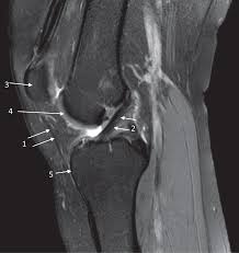 Magnetic resonance imaging (mri) tests involve large machines that use radio wave energy pulses and a magnetic field to produce images of the shoulder (2). Musculoskeletal System Book Chapter Iopscience