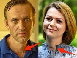 Alexei navalny, swiftly jailed upon returning to russia after months of treatment in germany for exposure to chemical weapons while he was in siberia, released a report tuesday accusing russian president vladimir putin of embezzling public funds to build his lavish estate on the black sea coast. Alexei Navalny Leaves Hospital Shows Scars Similar To Yulia Skripal