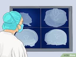 Check spelling or type a new query. Cara Menstimulasi Kelenjar Pituitari Dengan Gambar Wikihow