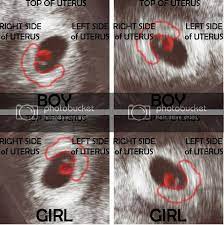 Pin On Ttc Pregnancy Birth And Baby