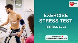 Image result for Exercise Stress Test