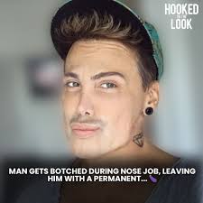 Neven started getting cosmetic procedures at the age of 21 and has since  undergone several treatments to achieve his ideal appearance — including  changing his eye color, receiving an eyebrow transplant, and