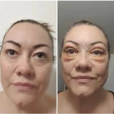 Star Aesthetics Glasgow