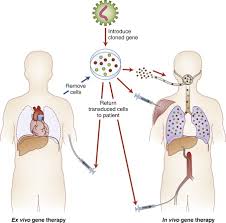 Somatic Gene Therapy An Overview Sciencedirect Topics