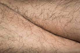 From latin hirsutus meaning hairy. Excessive Or Unwanted Hair In Women Causes And Natural Treatments