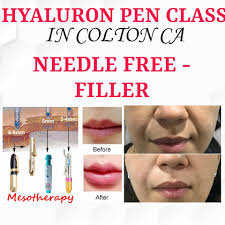 See more of no needle lip filler training on facebook. Hyaluron Pen Training Lip Filler Bella Spa Academy Facebook