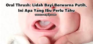 Sekitar 30 menitan menunggu akhirnya kartu bpjs bayi selesai dicetak dalam bentuk kertas hvs jadi harus di. Oral Thrush Lidah Bayi Berwarna Putih Ini Apa Yang Ibu Perlu Tahu