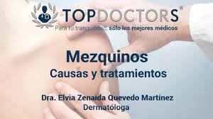 Mezquinos Cuales Son Las Causas Y Tratamientos Youtube