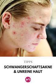 Pin Auf Tipps Schwangerschaft