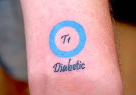 Choose your desired amount of type 1 diabetes tattoos from the drop down menu, and add to cart. Diabetes Tattoo Als Lebensretter Kliniken Sind Skeptisch Regionalheute De