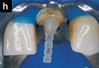 Maybe you would like to learn more about one of these? Dentistry Today